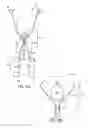 Fig. 12 - Method of removing excess fluid from a patient with hemodilution