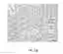 Fig. 28 - Method of removing excess fluid from a patient with hemodilution