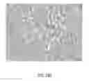 Fig. 30 - Method of removing excess fluid from a patient with hemodilution