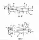 Fig. 05 - Intravascular ventricular assist device
