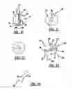 Fig. 06 - Intravascular ventricular assist device