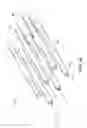 Fig. 03 - Implantable heart treatment systems, devices, and methods
