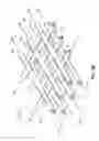 Fig. 04 - Implantable heart treatment systems, devices, and methods