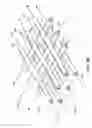 Fig. 04 - Implantable heart treatment systems, devices, and methods