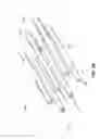 Fig. 03 - Implantable heart treatment systems, devices, and methods
