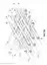 Fig. 04 - Implantable heart treatment systems, devices, and methods