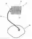 Fig. 01 - Continuous implantable peritoneal dialysis