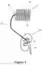 Fig. 02 - Continuous implantable peritoneal dialysis