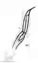 Fig. 02 - ARTERIOVENOUS ACCESS VALVE SYSTEM WITH SEPARATE VALVE TUBES