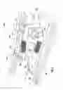 Fig. 03 - ARTERIOVENOUS ACCESS VALVE SYSTEM WITH SEPARATE VALVE TUBES