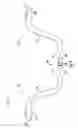 Fig. 05 - ARTERIOVENOUS ACCESS VALVE SYSTEM WITH SEPARATE VALVE TUBES