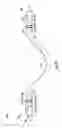 Fig. 10 - ARTERIOVENOUS ACCESS VALVE SYSTEM WITH SEPARATE VALVE TUBES