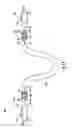 Fig. 11 - ARTERIOVENOUS ACCESS VALVE SYSTEM WITH SEPARATE VALVE TUBES