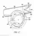 Fig. 18 - Oscillating positive respiratory pressure device