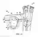 Fig. 19 - Oscillating positive respiratory pressure device