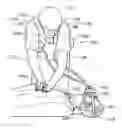 Fig. 01 - Emergency Air Delivery System for Patients