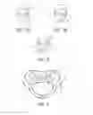 Fig. 03 - Determining information about a patients face
