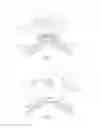 Fig. 07 - CPAP mask and system