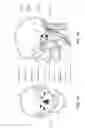 Fig. 12 - Respiratory apparatus