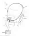 Fig. 01 - Patient interface device and maintaining apparatus and maintaining member therefor