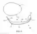 Fig. 06 - Patient interface device and maintaining apparatus and maintaining member therefor