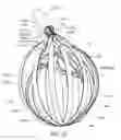 Fig. 09 - Medical device systems and methods including safety release, lumen fluid-providing mechanisms, or both