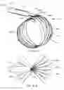 Fig. 14 - Medical device systems and methods including safety release, lumen fluid-providing mechanisms, or both