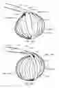 Fig. 17 - Medical device systems and methods including safety release, lumen fluid-providing mechanisms, or both