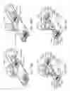 Fig. 35 - Medical device systems and methods including safety release, lumen fluid-providing mechanisms, or both