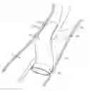 Fig. 01 - DEVICES AND METHODS FOR TREATING LOWER EXTREMITY VASCULATURE