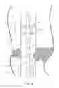 Fig. 05 - DEVICES AND METHODS FOR TREATING LOWER EXTREMITY VASCULATURE