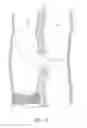 Fig. 08 - DEVICES AND METHODS FOR TREATING LOWER EXTREMITY VASCULATURE