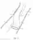 Fig. 10 - DEVICES AND METHODS FOR TREATING LOWER EXTREMITY VASCULATURE