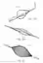 Fig. 24 - DEVICES AND METHODS FOR TREATING LOWER EXTREMITY VASCULATURE
