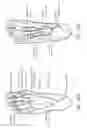 Fig. 27 - DEVICES AND METHODS FOR TREATING LOWER EXTREMITY VASCULATURE