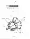 Fig. 02 - Retrievable devices for treating heart failure