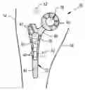 Fig. 01 - Drug delivery implants