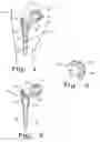 Fig. 02 - Drug delivery implants