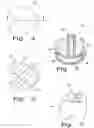 Fig. 03 - Drug delivery implants