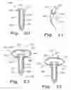 Fig. 11 - Drug delivery implants
