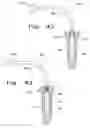 Fig. 14 - Drug delivery implants