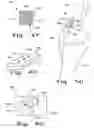 Fig. 16 - Drug delivery implants