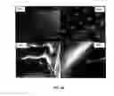 Fig. 22 - Transdermal delivery of high viscosity bioactive agents