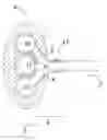 Fig. 01 - Venous Access Implantable Port