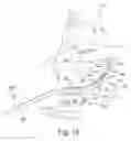 Fig. 16 - SURGICAL GUIDE AND METHOD FOR GUIDING A THERAPY DELIVERY DEVICE INTO THE PTERYGOPALATINE FOSSA