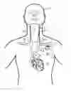 Fig. 01 - Implantable neurostimulator-implemented method for enhancing heart failure patient awakening through vagus nerve stimulation
