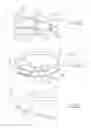 Fig. 07 - BASKETBALL NET DEVICE AND IMPROVEMENTS THEREIN