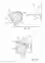 Fig. 10 - BASKETBALL NET DEVICE AND IMPROVEMENTS THEREIN