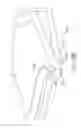 Fig. 20 - BASKETBALL NET DEVICE AND IMPROVEMENTS THEREIN