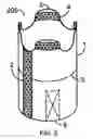 Fig. 03 - Water rocket fin attachment system